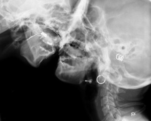 5d879e42cd4ebb52523ae54b1c65ea4c