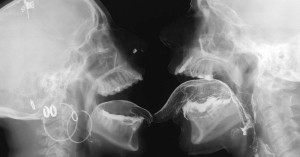 ffeafe478ef42aaa8d4a87acedc5785f