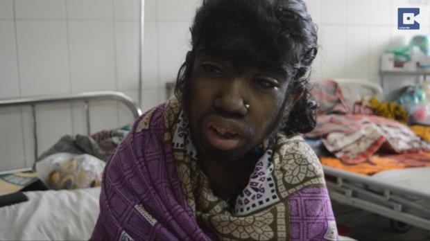 Girl__12__suffers__2840952n