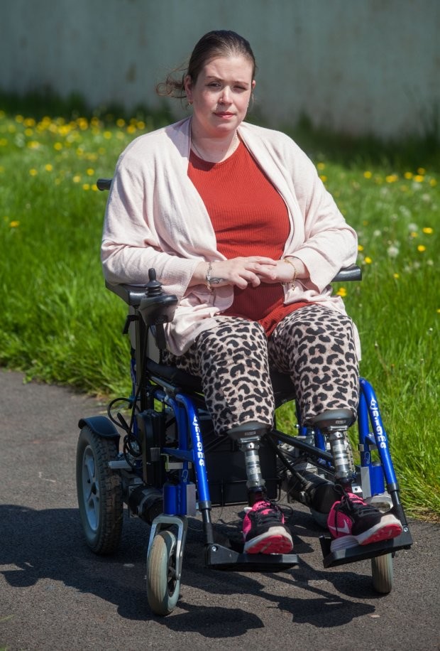 Ella Clarke from Torquay, Devon, had her legs amputated when hospital staff failed to check for blood clotting after having a C-section. See SWNS copy SWBABY: A mother who went into hospital to give birth woke up from an induced coma five days later - to find both of her legs amputated. Ella Clarke, 31, woke up in her hospital bed prepared to savour a moment she had waiting nine months to cherish. But instead of holding her baby girl, Winter Rose, doctors delivered news that would turn her world upside down. Surgeons had been forced to amputate both of Ella's legs due to complications and an alleged NHS blunder.