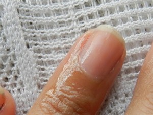 dry nails