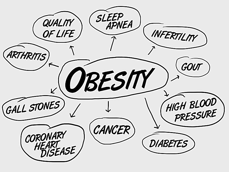 Obesity-in-Pakistan