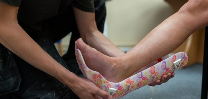 Use of Orthotics to Alleviate Pain!