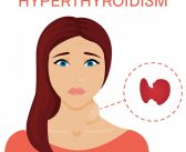 Effective ways to cure hyperthyroidism!